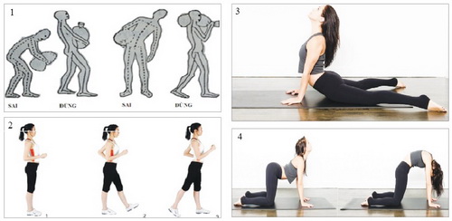 Thể dục giúp chữa thoát vị đĩa đệm